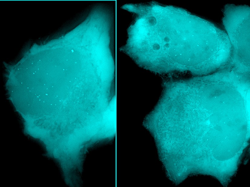 GFP spots in living cells