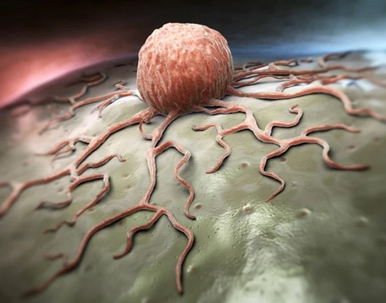 Penn study opens the door to let CAR T cells reach the tumor microenvironment - Blog