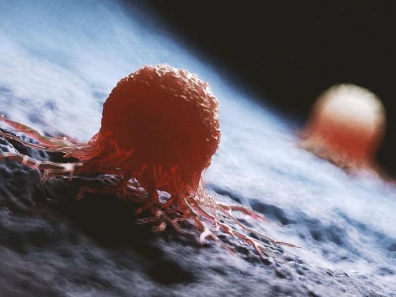 Dual-target CAR-T ‘very promising’ for advanced multiple myeloma - Blog