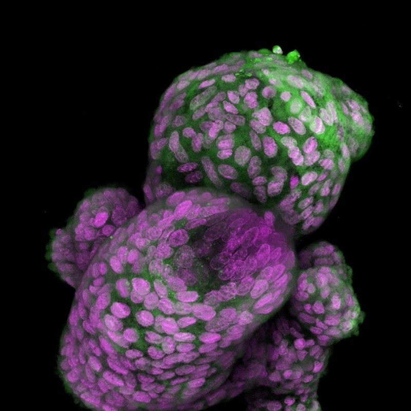 Researchers develop 3D organoid model to advance understanding of gastroesophageal junction cancer 1 - GEG Tech Researchers develop 3D organoid model to advance understanding of gastroesophageal junction cancer - Blog