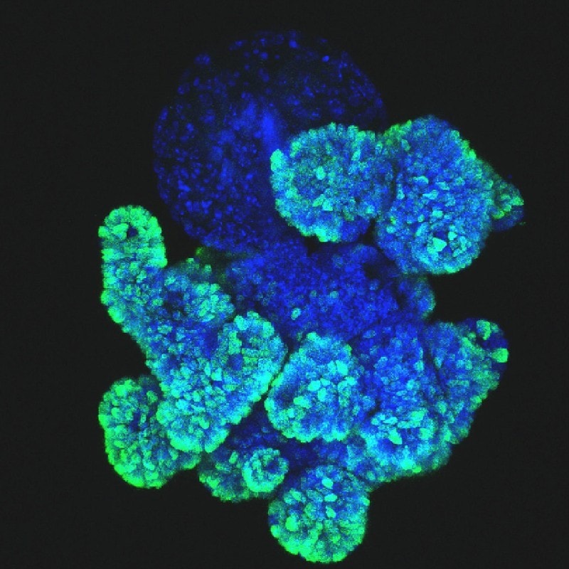Engineered human hepatocyte organoids enable CRISPR-based target discovery and drug screening for steatosis | Nature Biotechnology - Blog