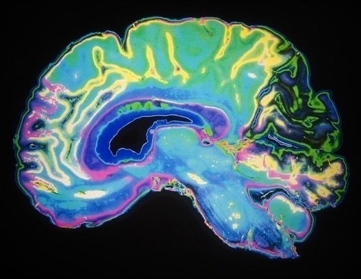 Scientists develop new immuno-therapeutic approach to target brain metastatic melanomas - Blog