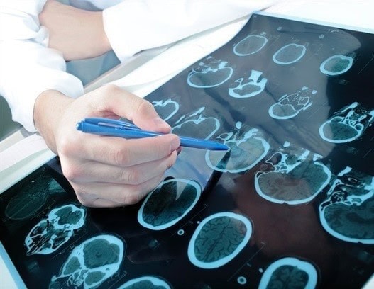 Innovative CAR T cell therapy shows promise for relapsed CIDP patients 1 - GEG Tech Innovative CAR T cell therapy shows promise for relapsed CIDP patients - Blog