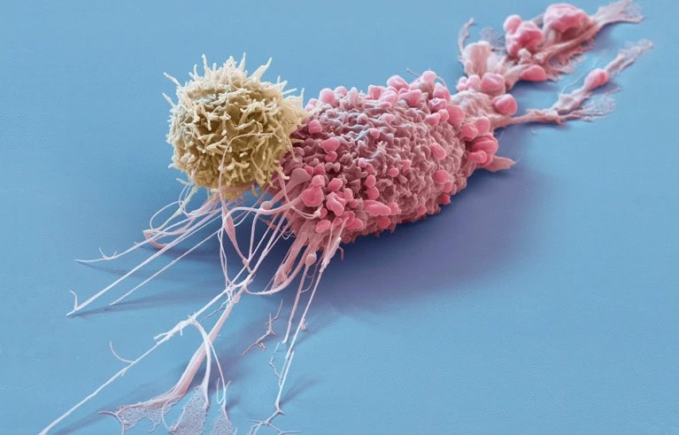 World-first therapy using donor cells sends autoimmune diseases into remission - Blog