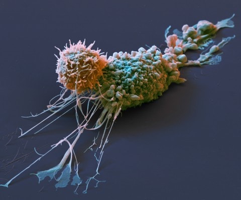 New approach reinvigorates exhausted T cells to improve tumor control 1 - GEG Tech New approach reinvigorates exhausted T cells to improve tumor control - Blog