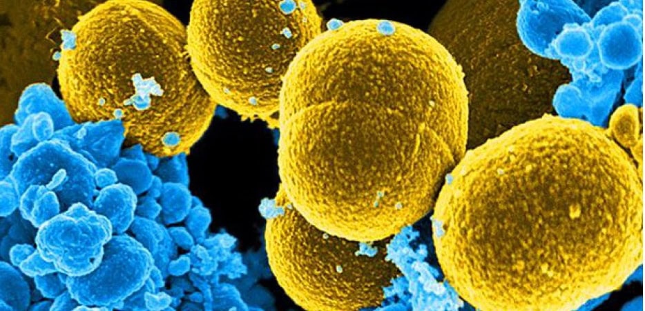 Researchers develop tool to enhance NK cells against cancer 1 - GEG Tech Researchers develop tool to enhance NK cells against cancer - Blog