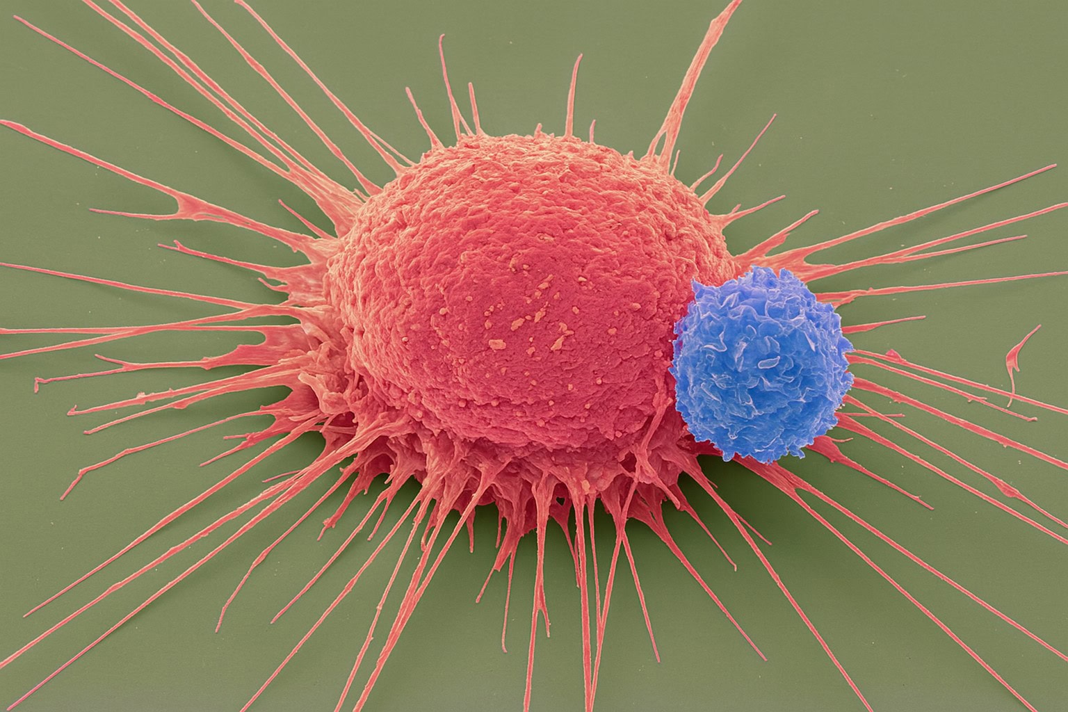 Cancer-fighting CAR T cells show promising results for hard-to-treat tumours 1 - GEG Tech Cancer-fighting CAR T cells show promising results for hard-to-treat tumours - Blog